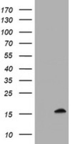 TSC22D1 Mouse anti-Human, Clone: OTI4A11, lyophilized, TrueMAB 100 &mu;g;