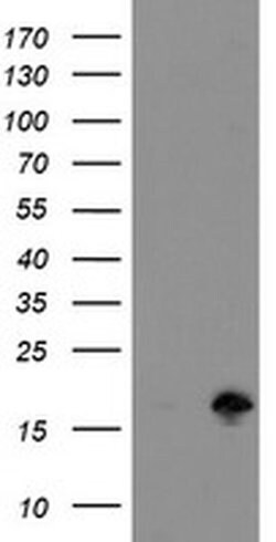 TSC22D1 Monoclonal Antibody (OTI3B7), TrueMAB , OriGene 100 &mu;L; Unconjugated:Antibodies,