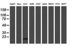 TSC22D1 Monoclonal Antibody (OTI3B7), TrueMAB , OriGene 100 &mu;L; Unconjugated:Antibodies,