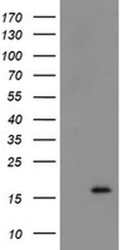 TSC22D1 Monoclonal Antibody (OTI4F1), TrueMAB , OriGene 30 &mu;L; Unconjugated:Antibodies,