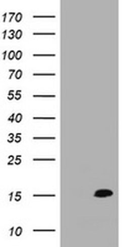 TSC22D3 Monoclonal Antibody (OTI1F11), TrueMAB , OriGene 30 &mu;L | Buy Online | Origene Technologies | Fisher Scientific