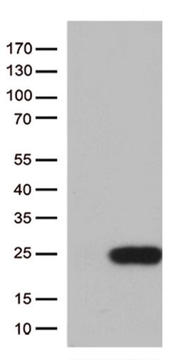 TSEN15 Monoclonal Antibody (OTI5A3), TrueMAB , OriGene 100 &mu;L; Unconjugated:Antibodies,