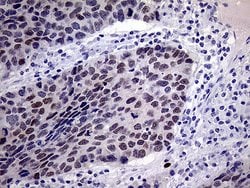 TSEN34 Monoclonal Antibody (OTI6B3), TrueMAB , OriGene 100 &mu;L; Unconjugated:Antibodies,