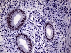 TSEN34 Monoclonal Antibody (OTI6B3), TrueMAB , OriGene 100 &mu;L; Unconjugated:Antibodies,
