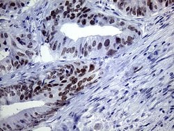 TSEN34 Monoclonal Antibody (OTI6B3), TrueMAB , OriGene 100 &mu;L; Unconjugated:Antibodies,