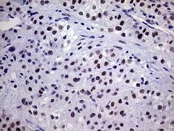 TSEN34 Monoclonal Antibody (OTI6B3), TrueMAB , OriGene 100 &mu;L; Unconjugated:Antibodies,