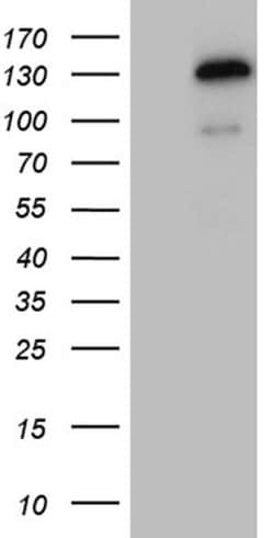TSHZ1 Monoclonal Antibody (OTI2G9), TrueMAB , OriGene 100 &mu;L; Unconjugated:Antibodies,