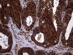 TSN Monoclonal Antibody (OTI1B5), TrueMAB , OriGene 100 &mu;L; Unconjugated:Antibodies,