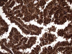 TSN Monoclonal Antibody (OTI1B5), TrueMAB , OriGene 100 &mu;L; Unconjugated:Antibodies,