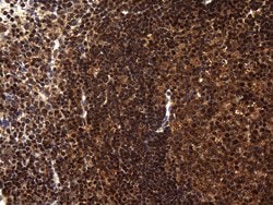 TSN Monoclonal Antibody (OTI1B5), TrueMAB , OriGene 100 &mu;L; Unconjugated:Antibodies,