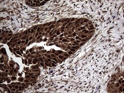 TSN Monoclonal Antibody (OTI1B5), TrueMAB , OriGene 100 &mu;L; Unconjugated:Antibodies,