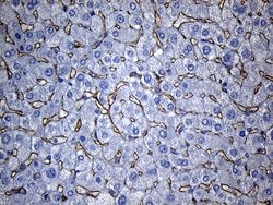 TSPAN7 Monoclonal Antibody (OTI2D6), TrueMAB , OriGene:Antibodies:Primary