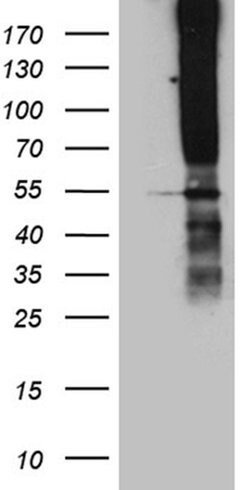 TSPAN7 Monoclonal Antibody (OTI2D6), TrueMAB , OriGene 30 &mu;L; Unconjugated:Antibodies,