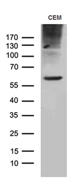 TSPAN7 Monoclonal Antibody (OTI2D6), TrueMAB , OriGene:Antibodies:Primary