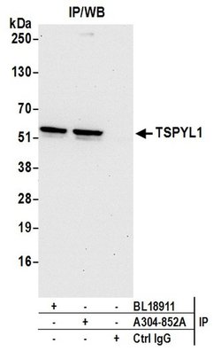 TSPYL1 Rabbit anti-Human, Polyclonal, Bethyl Laboratories 100 &mu;l; Unlabeled:Antibodies,