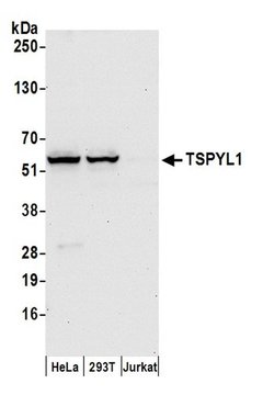 TSPYL1 Rabbit anti-Human, Polyclonal, Bethyl Laboratories 100 &mu;l; Unlabeled:Antibodies,