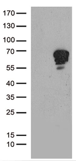 TSPYL1 Monoclonal Antibody (OTI6C6), TrueMAB , OriGene 100 &mu;L; Unconjugated:Antibodies,