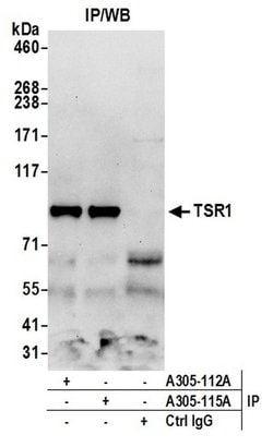 TSR1 Rabbit anti-Human, Polyclonal, Bethyl Laboratories 100 &mu;L; Unconjugated:Antibodies,