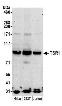 TSR1 Rabbit anti-Human, Polyclonal, Bethyl Laboratories 100 &mu;L; Unconjugated:Antibodies,