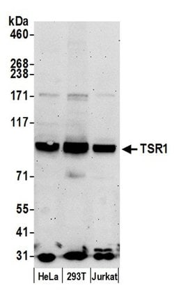 TSR1 Polyclonal Antibody, Bethyl Laboratories 20 &mu;L | Buy Online | Bethyl Laboratories, Inc | Fisher Scientific