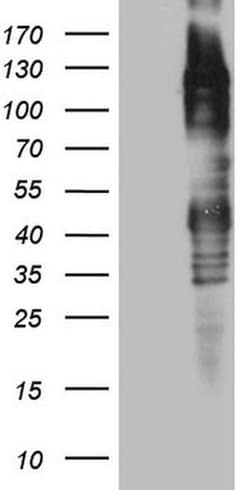 TTC14 Monoclonal Antibody (OTI1G9), TrueMAB , OriGene 100 &mu;L; Unconjugated:Antibodies,
