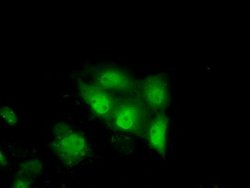 TTC32 Mouse anti-Human, Clone: OTI1F7, lyophilized, TrueMAB 100 &mu;g;