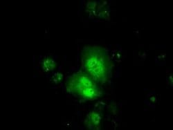 TTC32 Monoclonal Antibody (OTI2B9), TrueMAB , OriGene 30 &mu;L; Unconjugated:Antibodies,