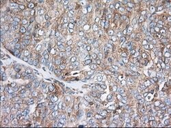 TTC32 Mouse anti-Human, Clone: OTI1F7, lyophilized, TrueMAB 100 &mu;g;