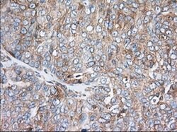 TTC32 Monoclonal Antibody (OTI1F7), TrueMAB , OriGene 100 &mu;L; Unconjugated:Antibodies,