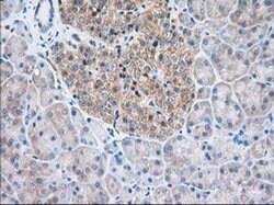 TTC32 Monoclonal Antibody (OTI1F7), TrueMAB , OriGene 100 &mu;L; Unconjugated:Antibodies,