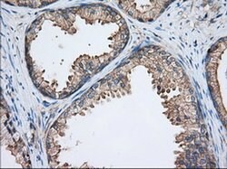 TTC32 Monoclonal Antibody (OTI1F7), TrueMAB , OriGene 100 &mu;L; Unconjugated:Antibodies,