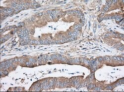 TTC32 Mouse anti-Human, Clone: OTI1F7, lyophilized, TrueMAB 100 &mu;g;