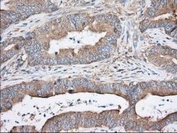 TTC32 Monoclonal Antibody (OTI1F7), TrueMAB , OriGene 100 &mu;L; Unconjugated:Antibodies,
