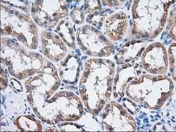 TTC32 Monoclonal Antibody (OTI3E11), TrueMAB , OriGene 30 &mu;L; Unconjugated:Antibodies,