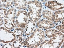 TTC32 Monoclonal Antibody (OTI3C2), TrueMAB , OriGene 100 &mu;L; Unconjugated:Antibodies,