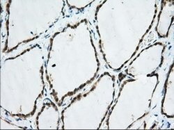 TTC32 Monoclonal Antibody (OTI2B9), TrueMAB , OriGene 30 &mu;L; Unconjugated:Antibodies,