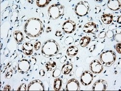TTC32 Monoclonal Antibody (OTI2B9), TrueMAB , OriGene:Antibodies:Primary