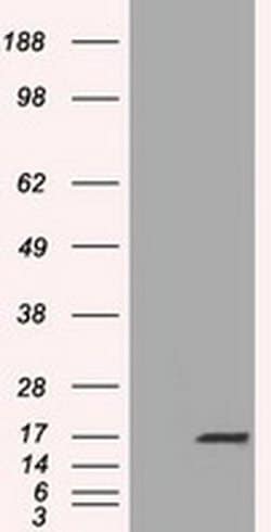 TTC32 Monoclonal Antibody (OTI1F7), TrueMAB , OriGene 100 &mu;L; Unconjugated:Antibodies,