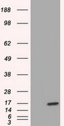 TTC32 Monoclonal Antibody (OTI3E11), TrueMAB , OriGene 30 &mu;L; Unconjugated:Antibodies,