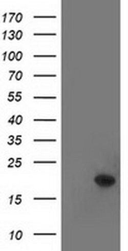 TTC32 Monoclonal Antibody (OTI4G10), TrueMAB , OriGene 30 &mu;L; Unconjugated:Antibodies,