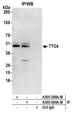 TTC4 Polyclonal Antibody, Bethyl Laboratories:Antibodies:Primary Antibodies