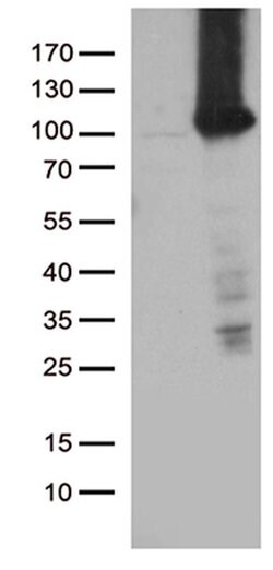 TTC7A Monoclonal Antibody (OTI1D4), TrueMAB , OriGene 100 &mu;L; Unconjugated:Antibodies,