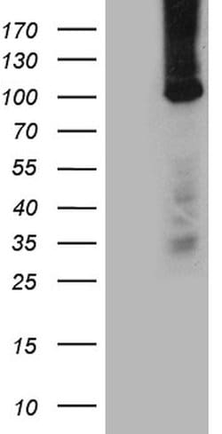 TTC7A Monoclonal Antibody (OTI4A2), TrueMAB , OriGene 100 &mu;L; Unconjugated:Antibodies,