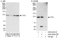 TTI1 Rabbit anti-Human, Polyclonal, Bethyl Laboratories 100 &mu;l; Unlabeled:Antibodies,