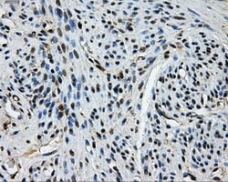 TTLL12 Mouse anti-Human, Clone: OTI1A2, lyophilized, TrueMAB 100 &mu;g;