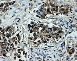 TTLL12 Mouse anti-Human, Clone: OTI1A2, lyophilized, TrueMAB 100 &mu;g;