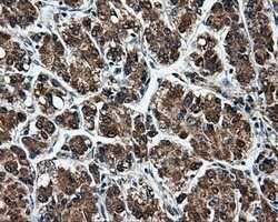 TTLL12 Mouse anti-Human, Clone: OTI1A2, lyophilized, TrueMAB 100 &mu;g;