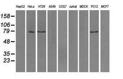 TTLL12 Mouse anti-Human, Rat, Clone: OTI4B2, lyophilized, TrueMAB 100 &mu;g;