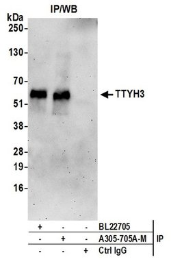 TTYH3 Polyclonal Antibody, Bethyl Laboratories 20 &mu;L | Buy Online | Bethyl Laboratories, Inc | Fisher Scientific
