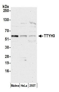 TTYH3 Polyclonal Antibody, Bethyl Laboratories 20 &mu;L | Buy Online | Bethyl Laboratories, Inc | Fisher Scientific